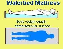 Total support from a waterbed